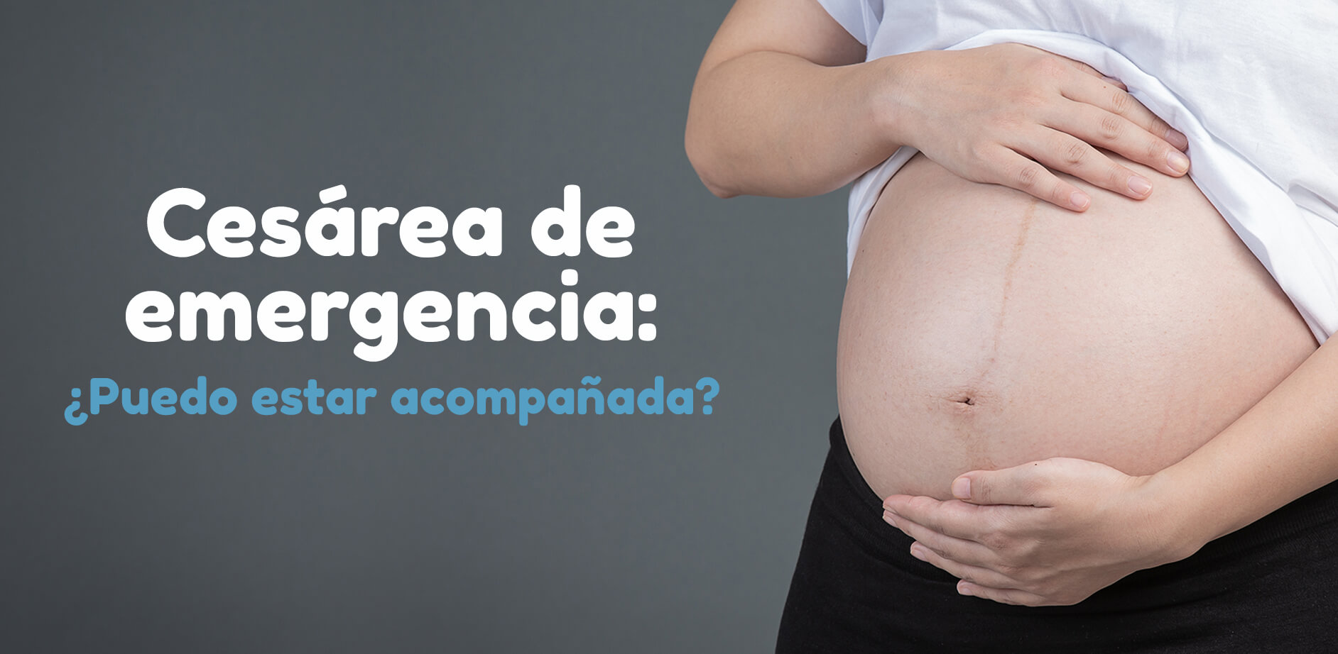 Cesárea de emergencia: ¿Puedo estar acompañada?