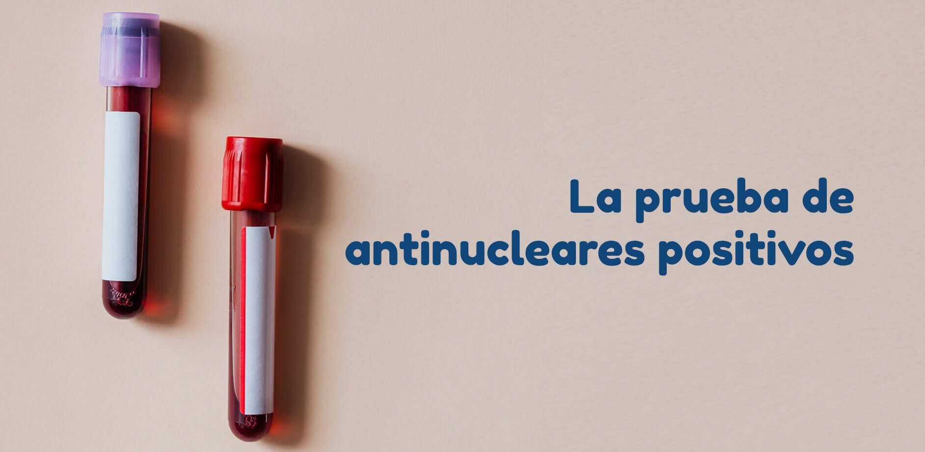 ¿Qué es la prueba de antinucleares positivos?